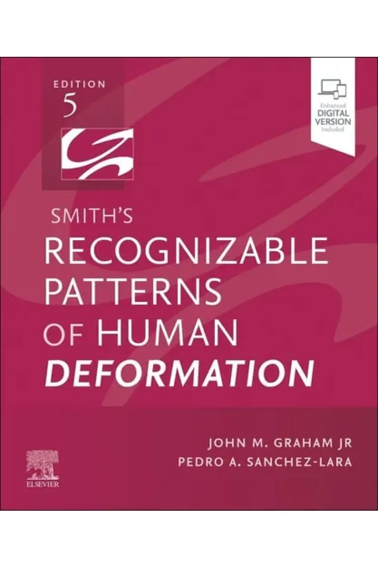 Smith's Recognizable Patterns of Human Deformation