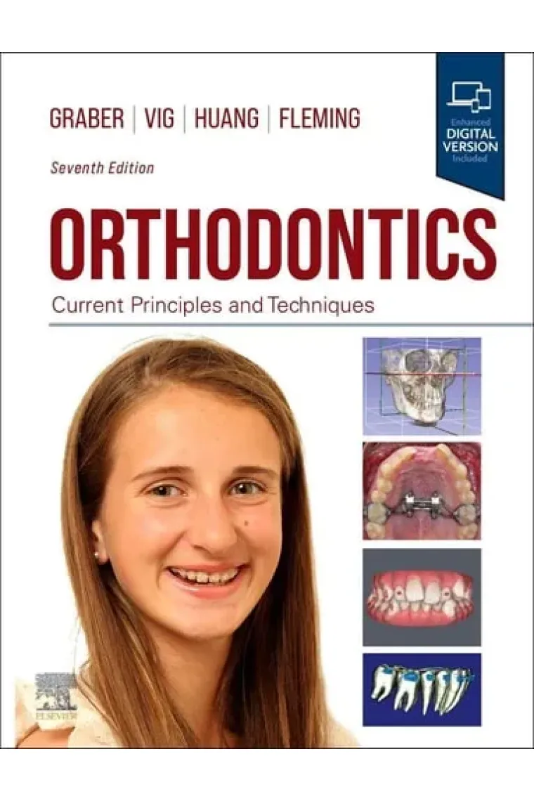 Orthodontics Current Principles and Techniques